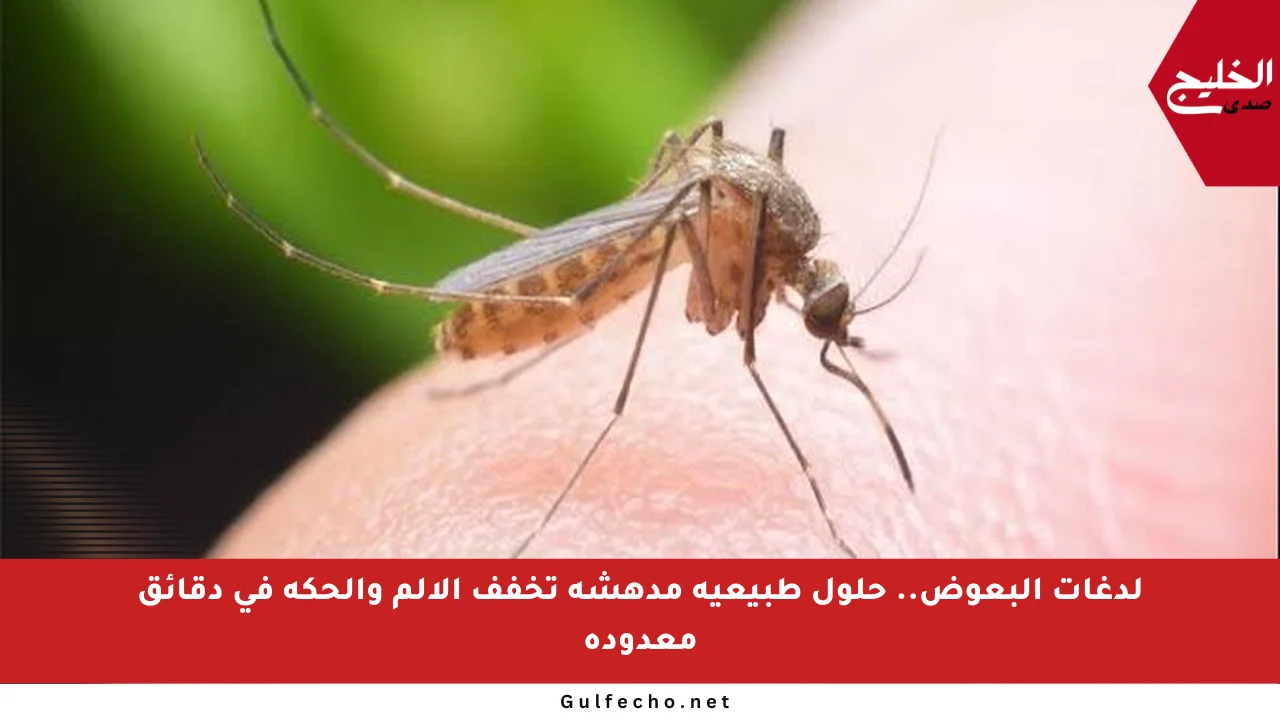 لدغات البعوض.. حلول طبيعية مدهشة تخفف الألم والحكة في دقائق معدودة